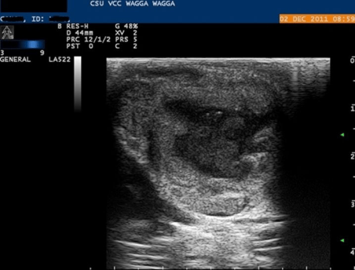 dental ultrasound