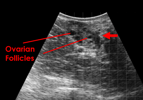 ovarian follicles