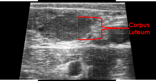 corpus luteum