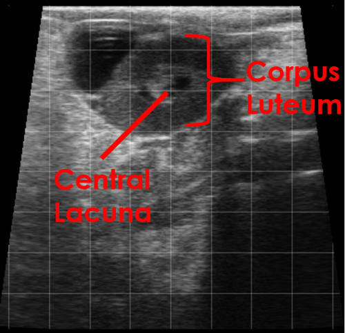 corpus luteum