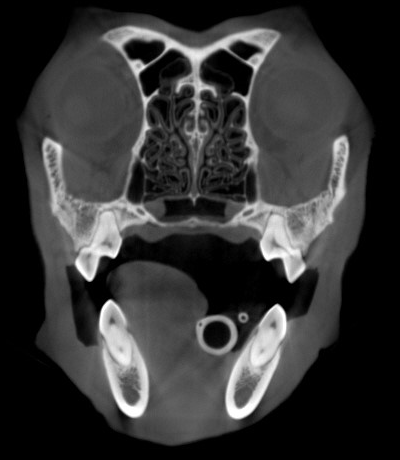 motion in the head