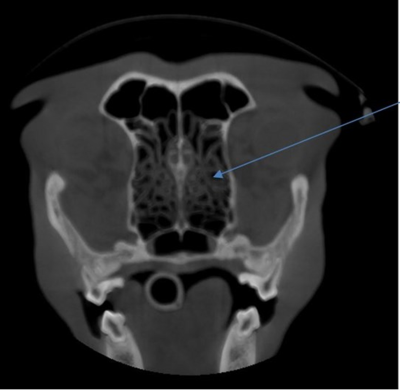 motion in the head
