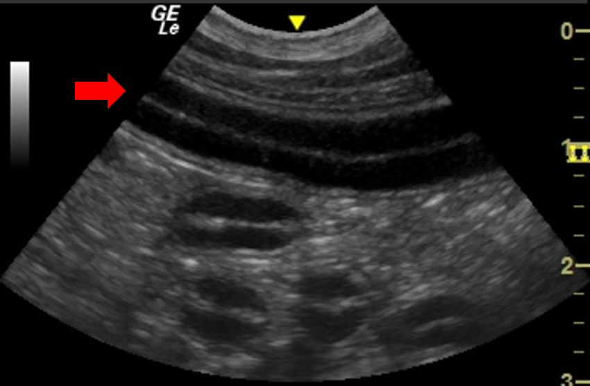 Duodenum