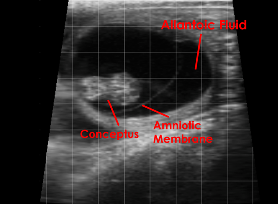 foetal viability