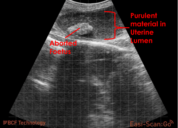 aborted foetus